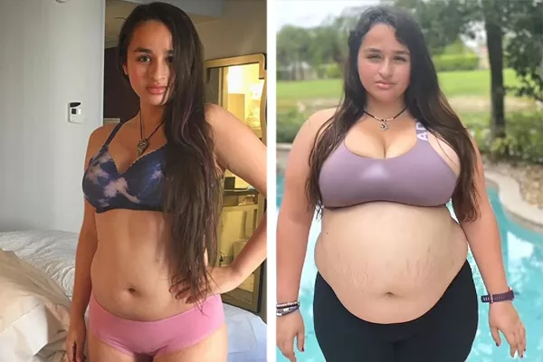 ג'אז ג'נינגס