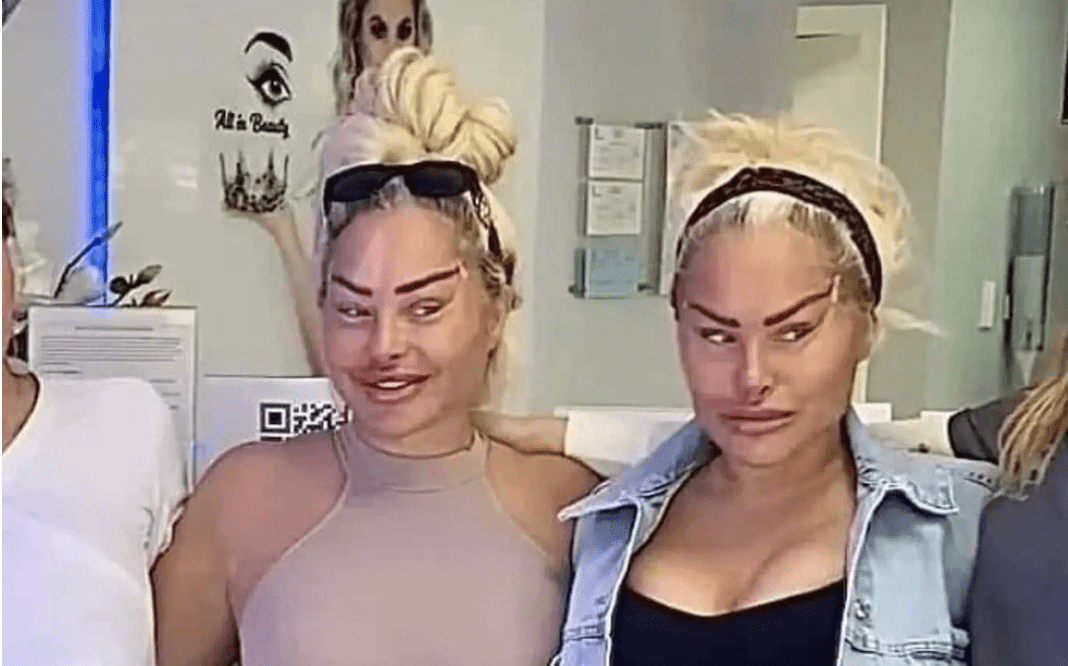 דארסי סילבה